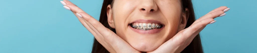 Multi-attaches céramique et métal au cabinet d'orthodontie du Dr Babayigit à Strasbourg